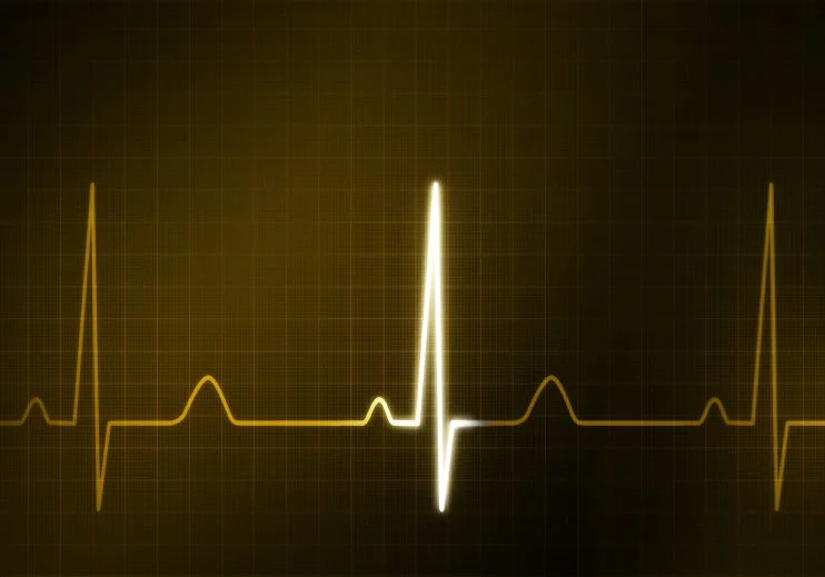 The graphic of EKG monitor for finance theme