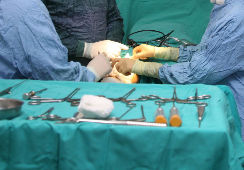 surgeons holding medical instruments in hands and looking at patient